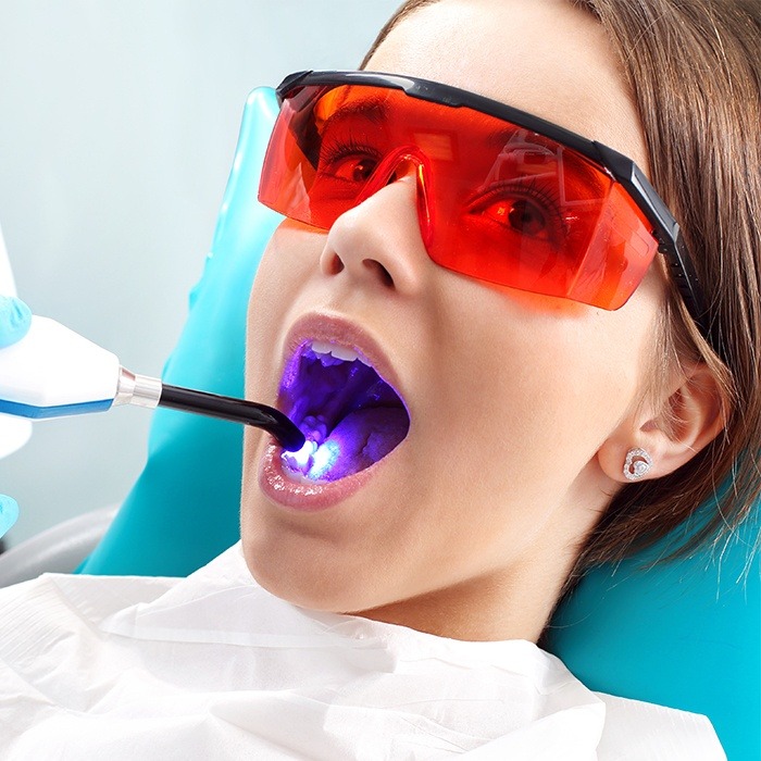 Laser Dental Treatment